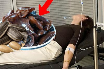 Gia đình 3 người nhập viện sau ăn khuya, nguyên nhân từ 2 món ăn quen thuộc