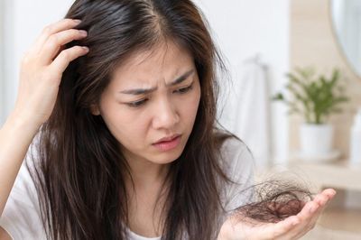 Viêm da tiết bã có gây rụng tóc?