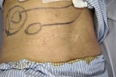 Virus 'ẩn dật' trong cơ thể, gây đau dữ dội cho bệnh nhân suốt 3 năm
