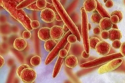 Ca tử vong do viêm phổi chưa rõ nguyên nhân ở Nga: Bộ Y tế khuyến cáo người dân điều gì?