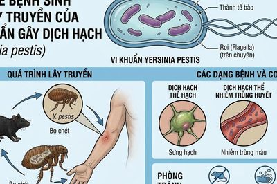Dịch hạch nguy hiểm thế nào, tại sao chưa tiêm vaccine đại trà?
