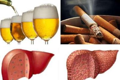 Hút thuốc lá và bệnh gan