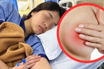 Ngứa ngực suốt 8 tháng, bất ngờ mắc ung thư phải cắt bỏ hai bên vú