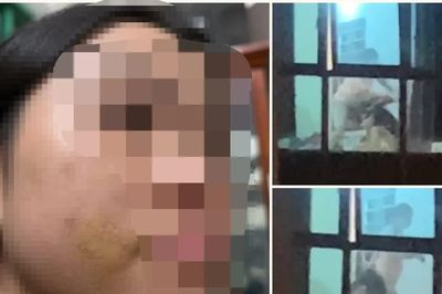 Xác minh vụ bé gái bị mẹ kế bạo hành ở Phú Thọ