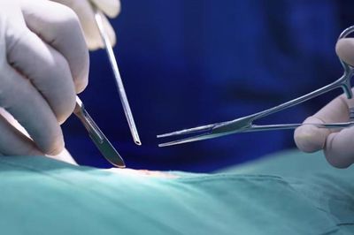 Cụ bà 74 tuổi vào viện phẫu thuật chân phải, bác sĩ cắt nhầm chân trái
