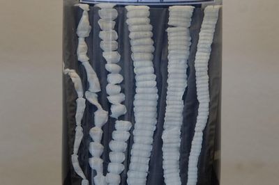 Món khoái khẩu khiến người phụ nữ có sán dài hơn 70 cm mà không biết