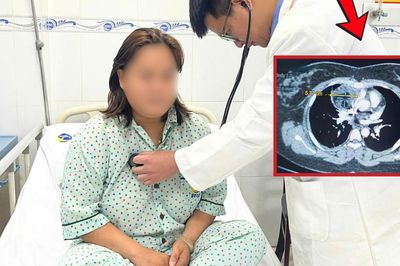 Đột ngột khó thở, cô gái 27 tuổi nhập viện phát hiện u quái trung thất