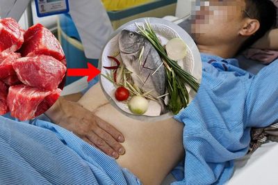 Polyp đại tràng tái phát, người đàn ông bỏ thịt ăn cá nhận kết quả bất ngờ