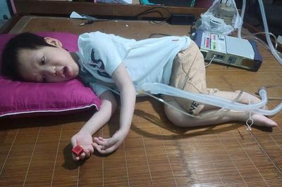 Bé trai ở Hưng Yên bị bại não, suốt 8 năm sống phụ thuộc vào máy thở