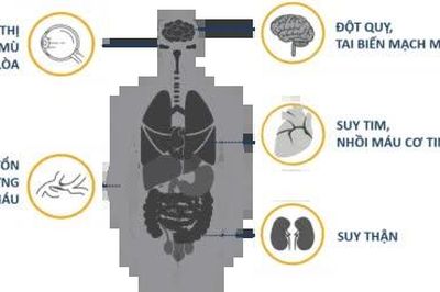 Đo huyết áp tại nhà - những điều cần lưu ý