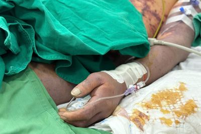 Món khoái khẩu khiến nhiều người Việt vô tình rước ổ vi khuẩn