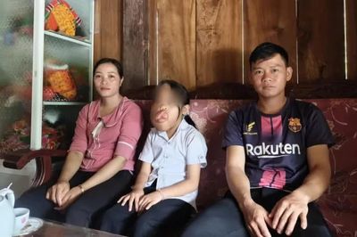 Đắk Lắk: Cô học trò có khối u trên mặt được phẫu thuật miễn phí