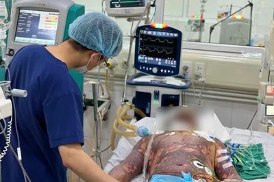 4 người nhập viện vì liên cầu lợn, có bệnh nhân nguy kịch