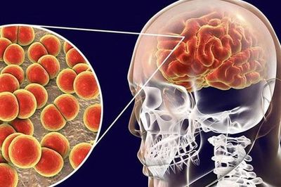 Sau chùm ca bệnh nhiễm não mô cầu tại trường học ở TP. HCM, Bộ Y tế khuyến cáo gì?