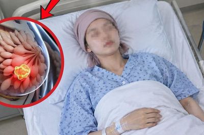 Cô gái mới 19 tuổi đã mắc ung thư vú, hối hận vì bỏ qua điều này