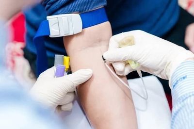 Mẹo kiểm tra trên da giúp cha mẹ phát hiện dấu hiệu nguy hiểm của bệnh não mô cầu