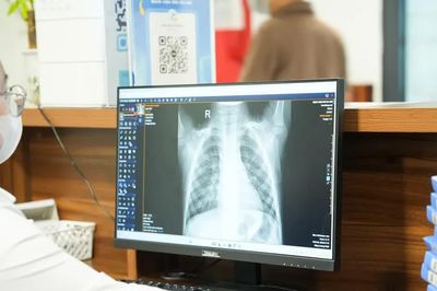 Cục Phòng bệnh lưu ý 4 nhóm có nguy cơ biến chứng nặng do cúm mùa