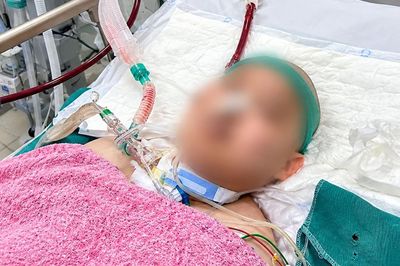 Tiêm thuốc chữa vảy nến, người đàn ông nguy kịch vì suy tuyến thượng thận