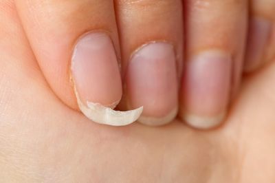 Những biểu hiện bất thường cảnh báo suy giáp
