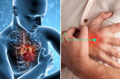 Người đàn ông 56 tuổi nhồi máu cơ tim cấp từ dấu hiệu nhiều người Việt bỏ qua