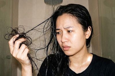 Rụng tóc bao nhiêu khi gội đầu là bình thường? 5 cách hạn chế rụng tóc