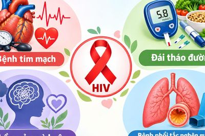 Sống chung với HIV và bệnh nền, làm gì để kiểm soát sức khỏe tốt hơn?