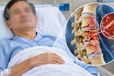 Cúm mãi không khỏi, người đàn ông 60 tuổi 'chết lặng' khi đi khám