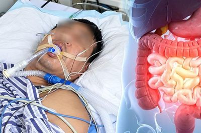 Rối loạn tiêu hóa suốt 2 tuần, người đàn ông bàng hoàng phát hiện ung thư