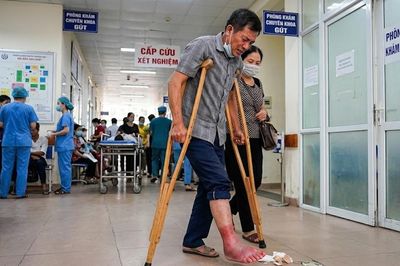 Tiến sĩ lý giải việc người đàn ông không lê nổi chân sau bữa ăn canh măng chua