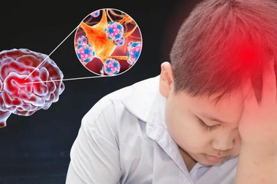 Hà Nội ghi nhận 2 ca não mô cầu, chủ động phòng bệnh từ những dấu hiệu sớm