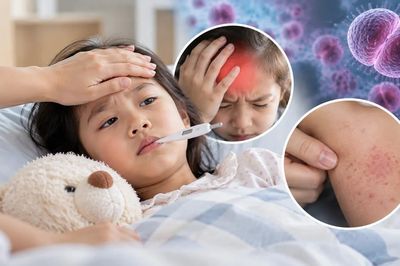 4 dấu hiệu nhiễm não mô cầu dễ bị nhầm với cảm cúm, có dấu hiệu này cần đi viện ngay