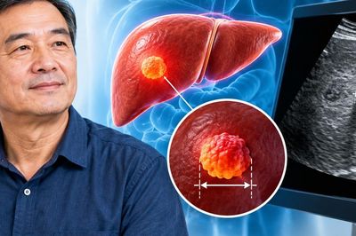 Người đàn ông không đau bụng, không vàng da vẫn phát hiện u gan gần 2 cm