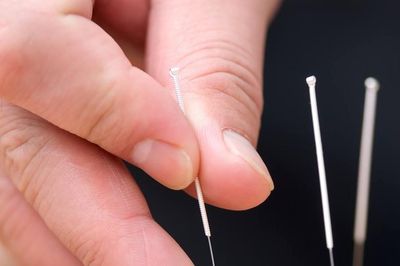 Mất ngủ nhiều năm, châm cứu bao lâu mới cải thiện?