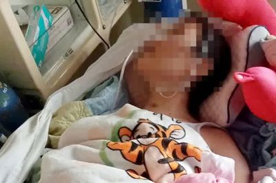 Nữ sinh tái phát tổn thương não sau tai nạn