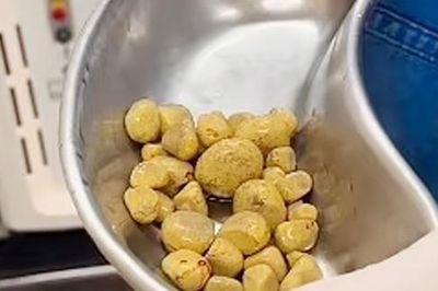 Những ai có nguy cơ bị sỏi thận cao nhất?