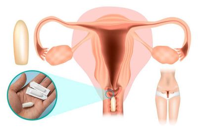 Vùng kín ngứa ngáy, đừng vội đặt thuốc nếu chưa biết điều này