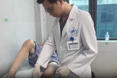 Vết loét chân kéo dài không lành có thể là dấu hiệu của bệnh lý tĩnh mạch