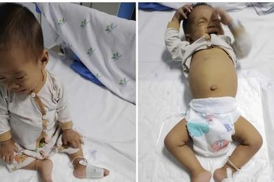 Bố mẹ cầu xin sự sống cho đứa con 10 tháng tuổi trong cảnh khánh kiệt