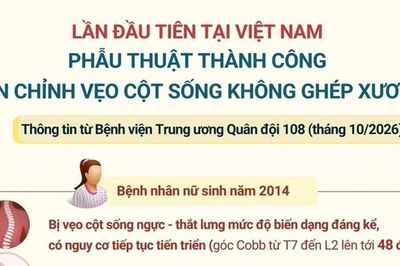 Kỹ thuật mới giúp bệnh nhân vẹo cột sống bảo tồn vận động