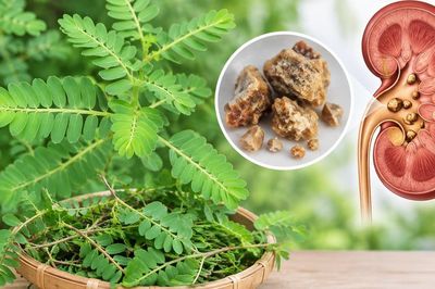 Cách dùng cây chó đẻ hỗ trợ điều trị sỏi tiết niệu