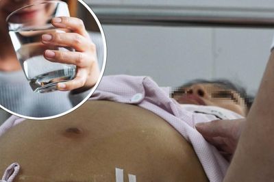 Uống 6 lít nước mỗi ngày làm đẹp da, người phụ nữ co giật rồi hôn mê