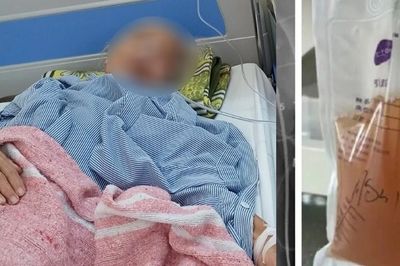 Bác sĩ hút 2,5 lít dịch mỗi ngày từ lồng ngực cụ bà