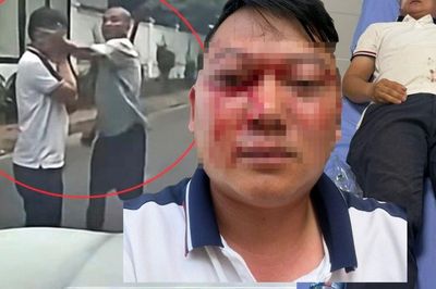 Vợ tài xế bị đánh gục giữa đường ở Phú Thọ tiết lộ thương tích của chồng