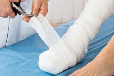 Sẹo bỏng co rút khiến bé trai 9 tuổi phải bò bằng tay