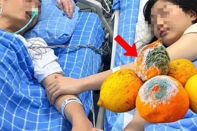 Hai vợ chồng chưa đầy 30 tuổi cùng mắc ung thư vì thói quen tiếc đồ ăn