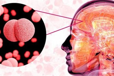Cà Mau: Ghi nhận 2 ca viêm não mô cầu, 1 trường hợp tử vong