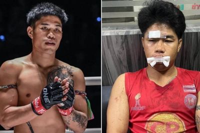Bị tấn công trên đường, võ sĩ Muay Thái gãy răng, phải khâu 9 mũi trên mặt
