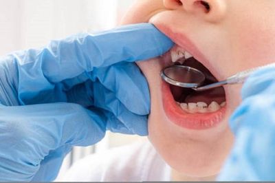 Khám sức khỏe toàn dân, TP.HCM phát hiện 24,9% học sinh sâu răng