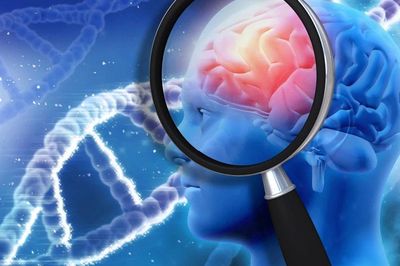 Phát hiện gene bảo vệ não trước bệnh Alzheimer