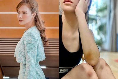 Đan Lê bầm dập vì cảnh bị đánh trong 'Anh có phải đàn ông không?'